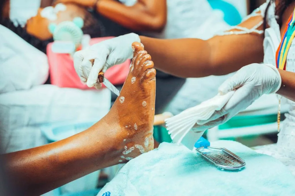 Benefits of Outpatient Wound Care