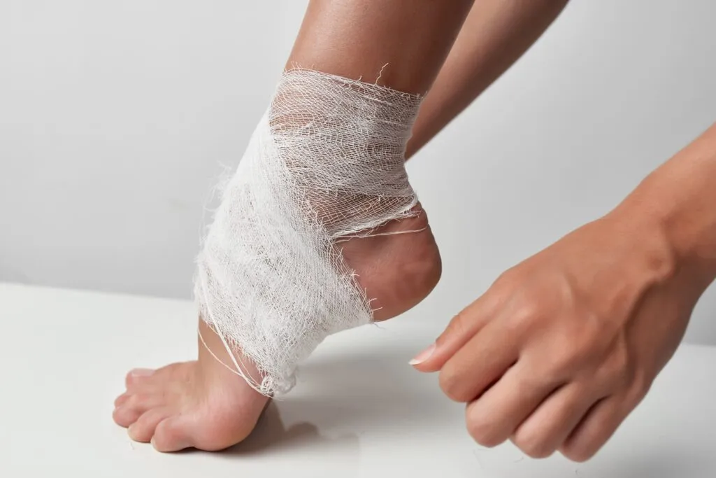 Probiotics , Chronic Wounds, immune support