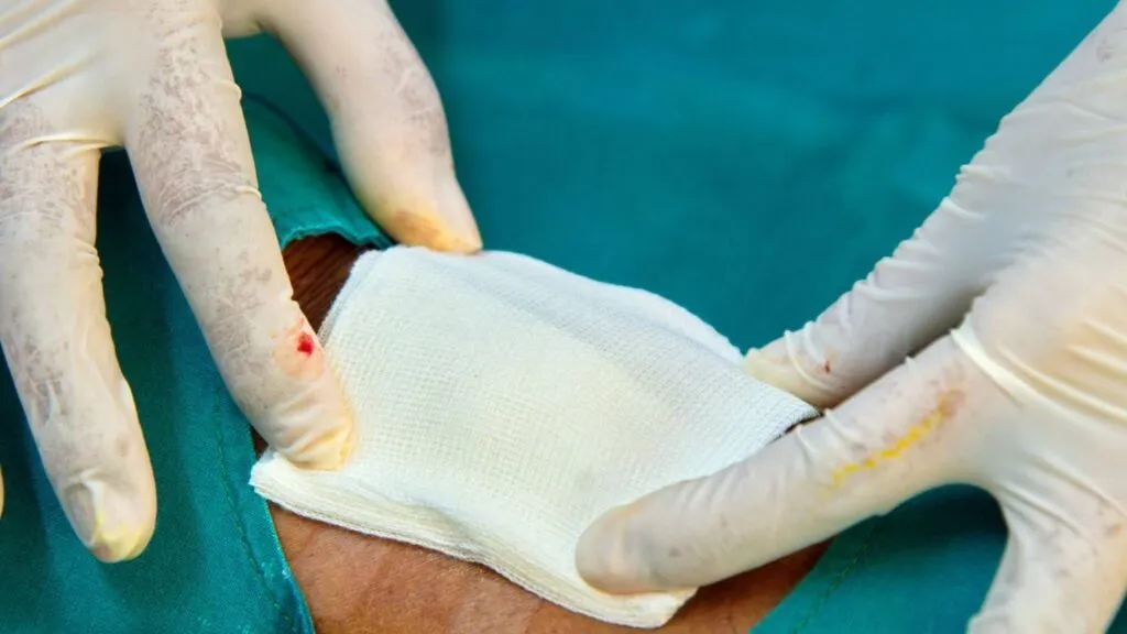 Post-surgical cancer patients