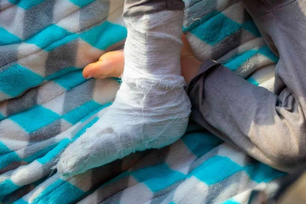 Chronic Wounds, depression, quality of life