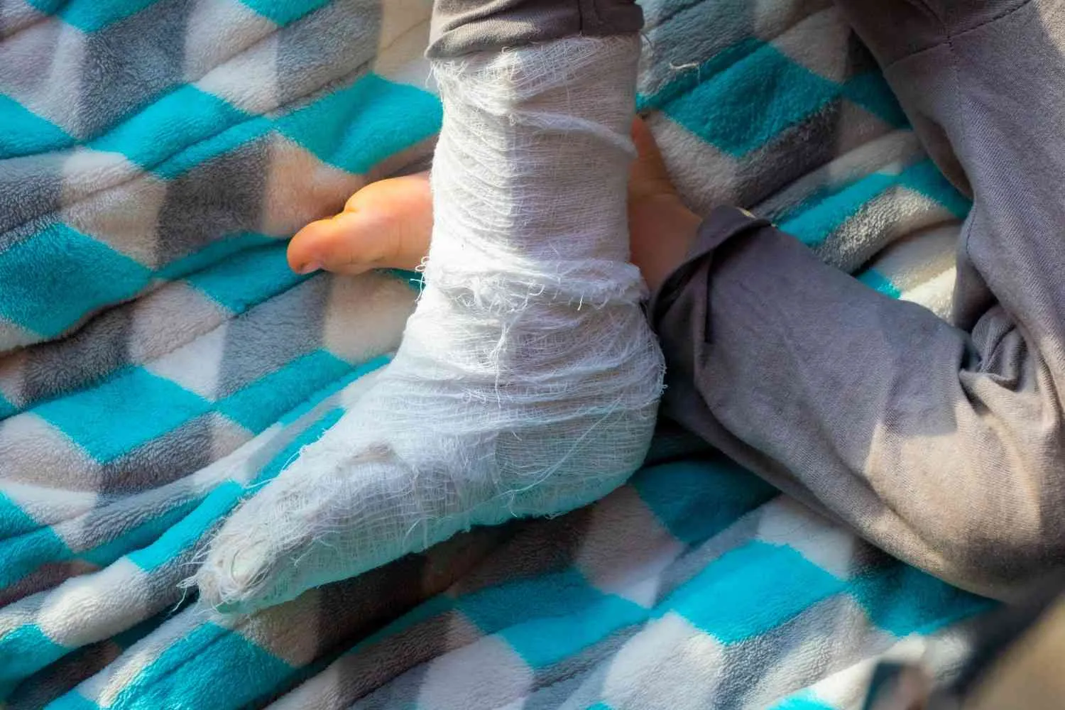 Chronic Wounds, depression, quality of life