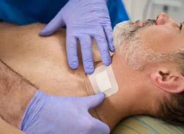 collagen pads, Non-Healing Wounds, collagen dressings