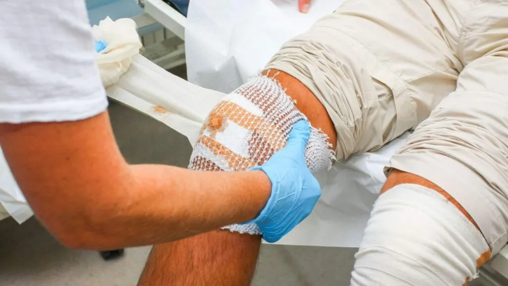 3D-Printed Dressings, bioengineered dressings, custom fit