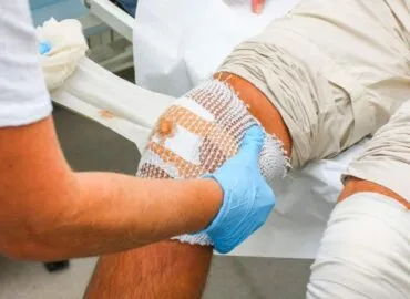 3D-Printed Dressings, bioengineered dressings, custom fit